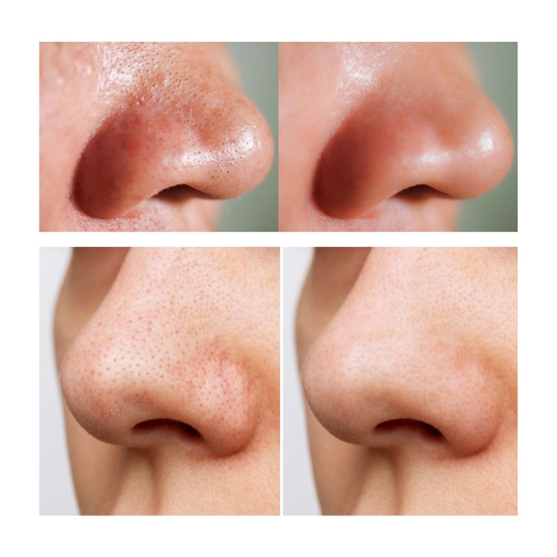 شوینده صورت کنترل منافذ آنوا Anua مدل Cleansing Oil(200 میل)